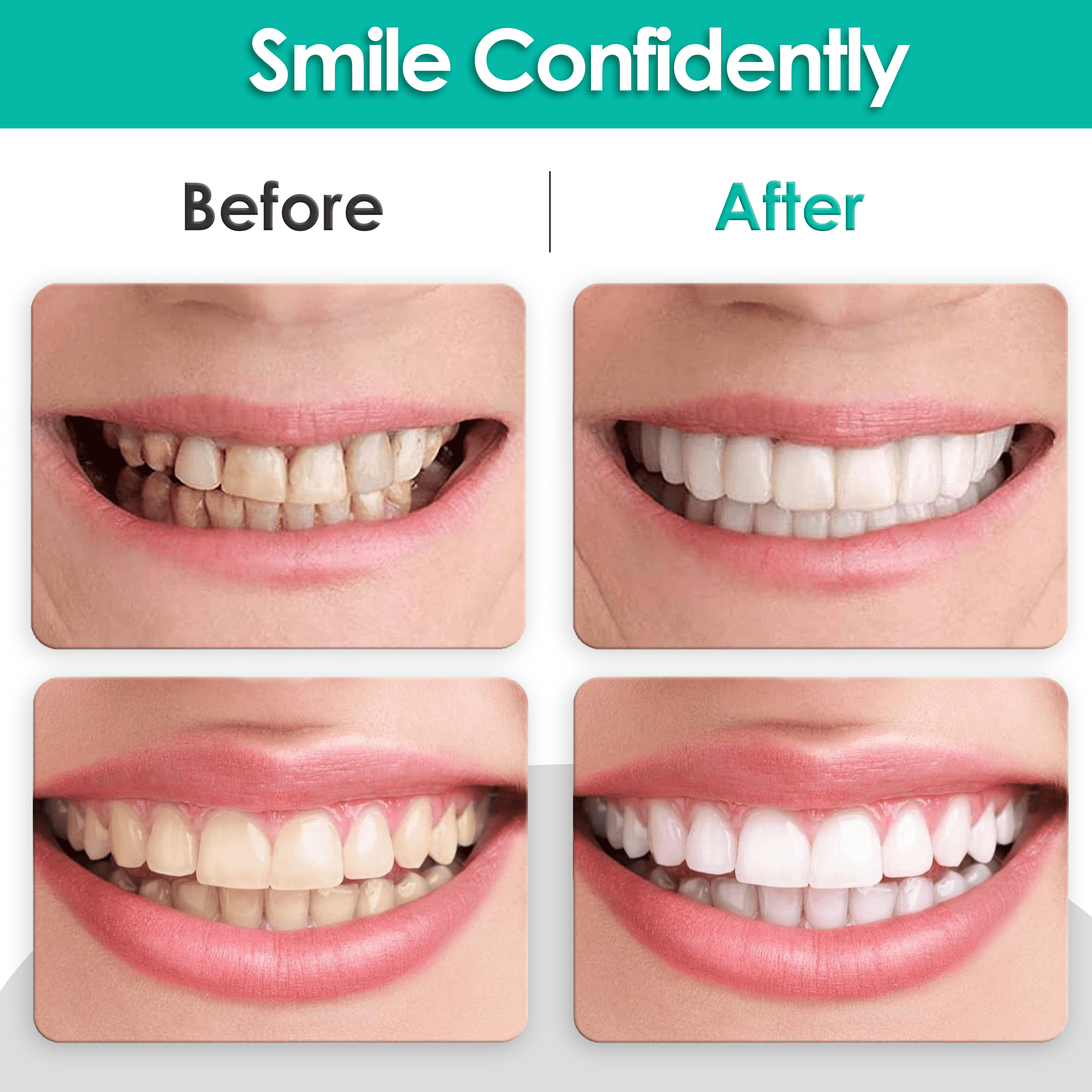 Dentures False Teeth Clip On DP4